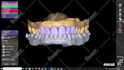 design dental design with exocad software for you