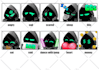 custom twitch emotes, discord emoji, sub badges, and animated for stream