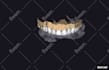 design precise dental cad models using exocad