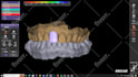 design dental design with exocad software for you