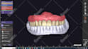design high quality dentures using exocad