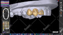 design custom tooth grills designs using exocad