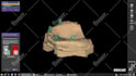 design dental design with exocad software for you
