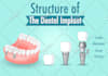 write SEO optimized medical and dental articles, and health blogs
