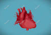 create a 3d model from your ct or mri dicoms