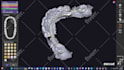 design high quality dentures using exocad