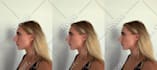 realistic nose job rhinoplasty photo simulation surgery