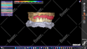 design high quality dentures using exocad