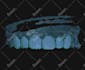 design any custom grillz in 3d cad