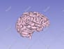 create a 3d model from your ct or mri dicoms