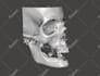 create medical 3d model from dicom, ct or mri images