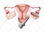 create surgical and anatomical art for medical professionals