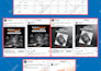 setup and manage ecommerce facebook ads campaign instagram ads shopify meta ads
