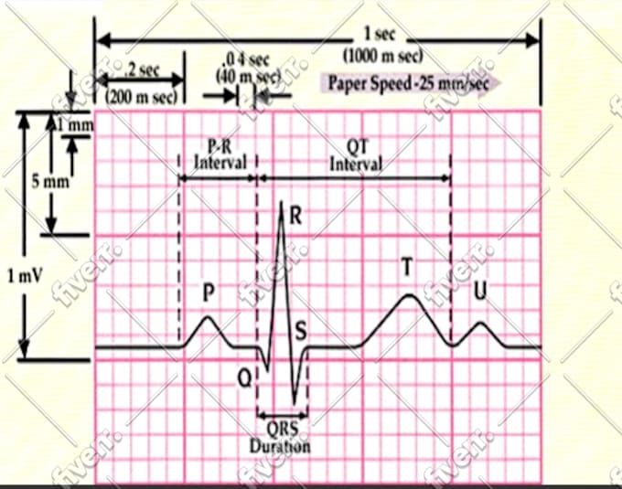 teach ecg,ekg interpretation, discussion ,it can be zoom class