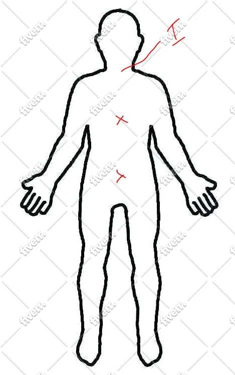 remove alien implants on your aura