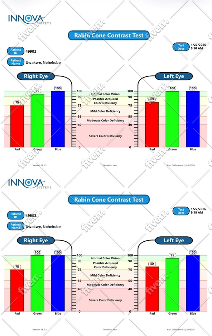 create editable butterfly, bar, pie and line graph