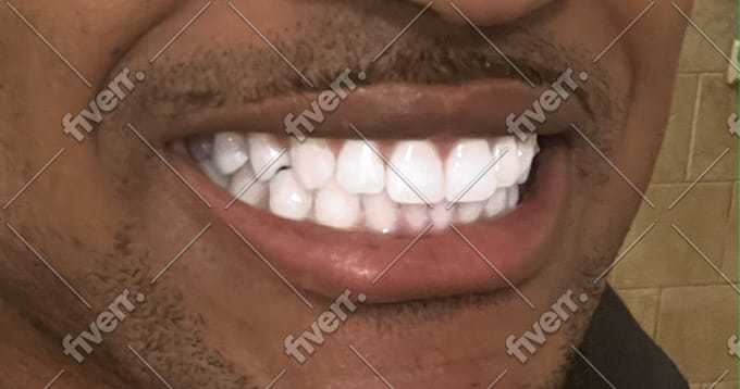 whiten, clean, and fix yellow teeth for stunning photos