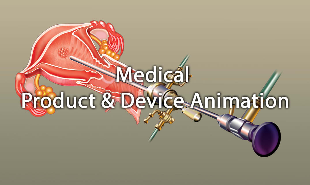 Do 3d medical product and device animation by Topazweb | Fiverr