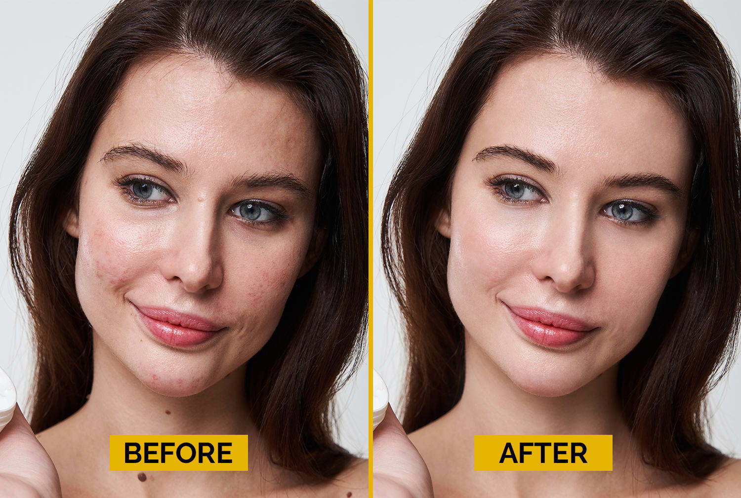 Remove wrinkles pimples and retouch skin in photoshop by