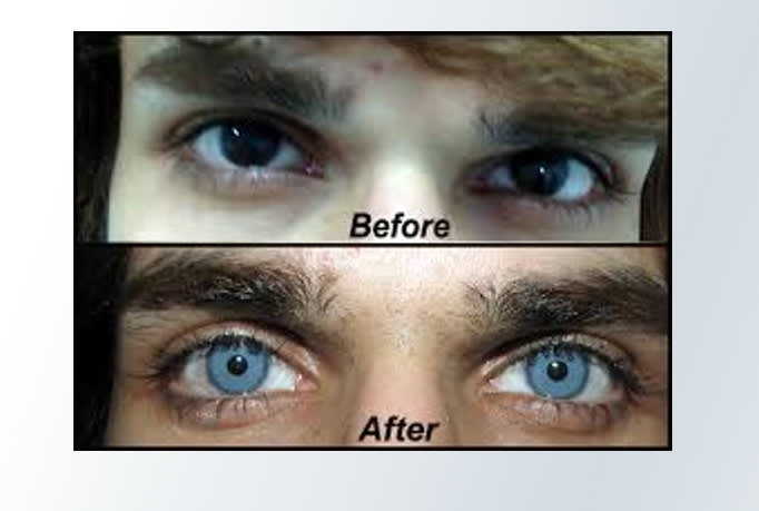 Cast Eye Color Permanent Changing Spell By Zamzam1098
