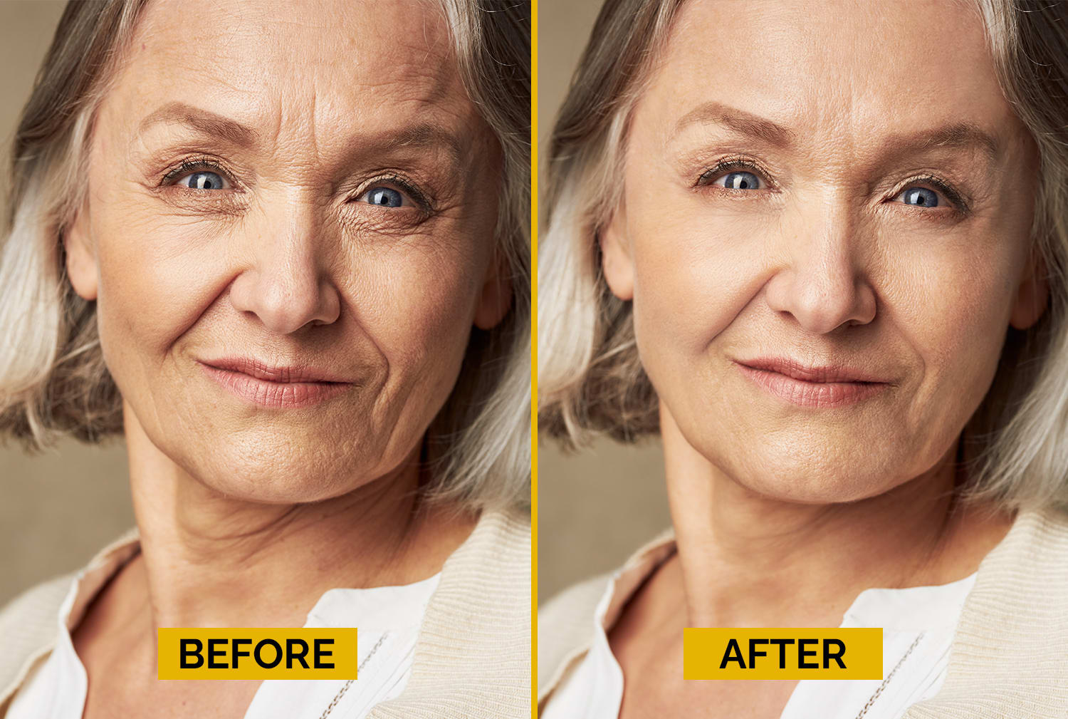 Remove wrinkles pimples and retouch skin in photoshop by