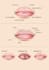 draw your medical illustration