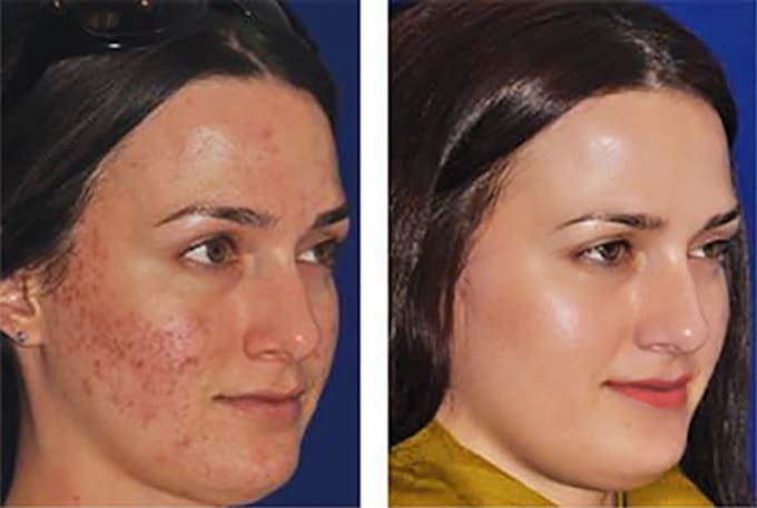 do high end beauty retouching and advanced retouching
