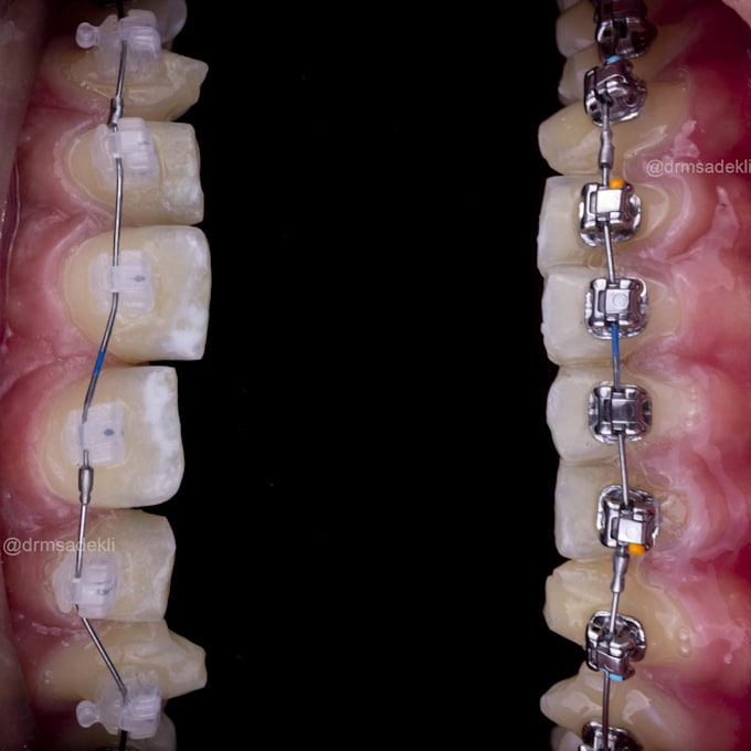 refine cosmetic or dental photos to make great posts