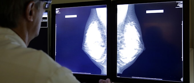 expert opinion as a radiologist on xray mri ct scan