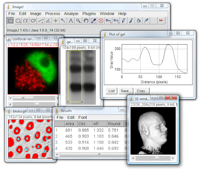Do imaging analysis using imagej software by Xhordil Fiverr
