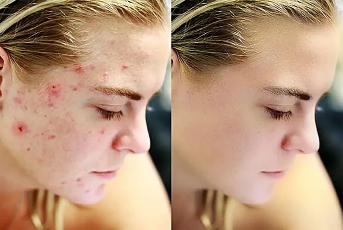 do photoshop editing background removal of images
