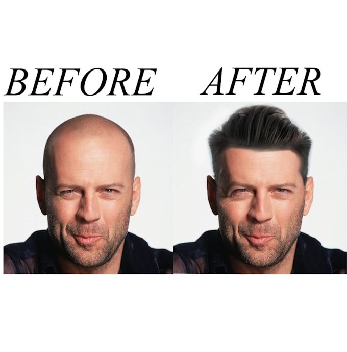 make hair on the bald head