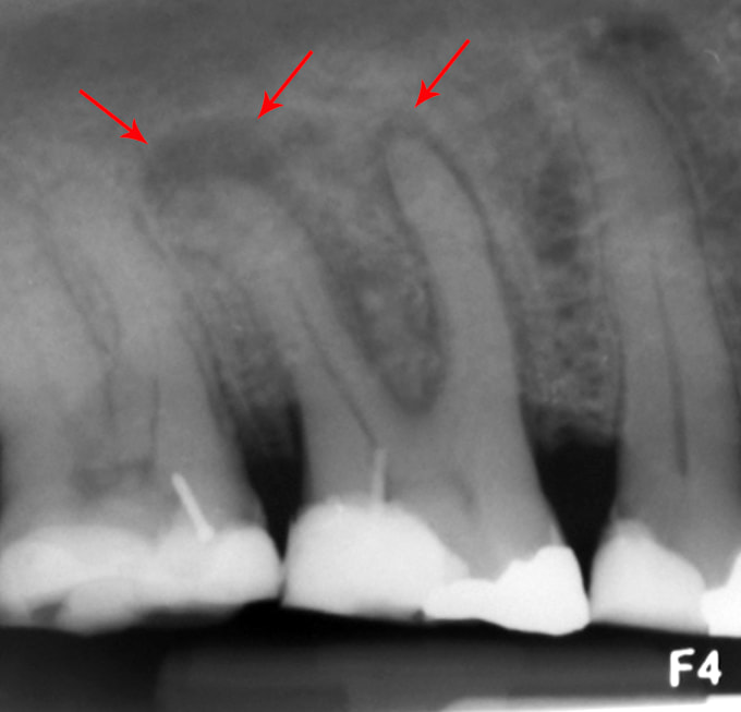 Write dental prescription and dental treatment plan by Bm11279 Fiverr