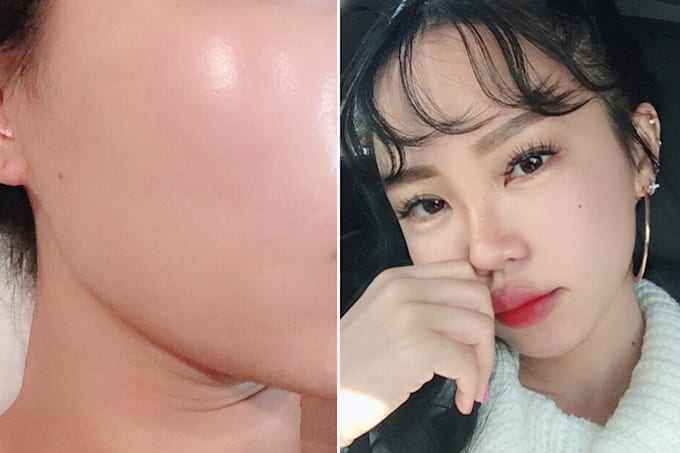 large pore skin care routine