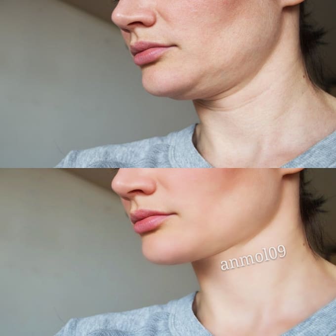 remove double chin body shape and body slimming in 1 hour