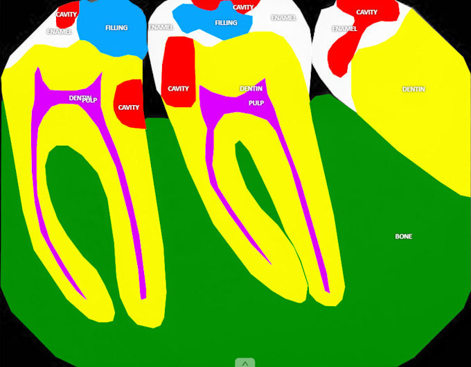 do dental image annotations accurately as a dentist for your ai