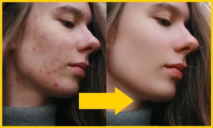 do high end skin retouching, photoshop retouch, wedding photo retouching