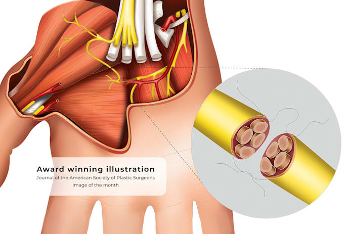 create surgical and anatomical art for medical professionals