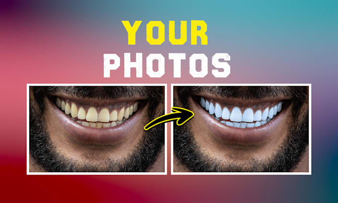 whiten, clean, and fix yellow teeth for stunning photos