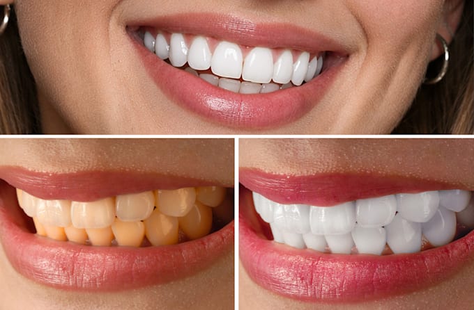 fix, whiten, and perfect your teeth smile in photoshop