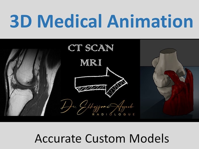 Create a medical 3d animation based on your ct or mri by Ayoubelhajjami ...