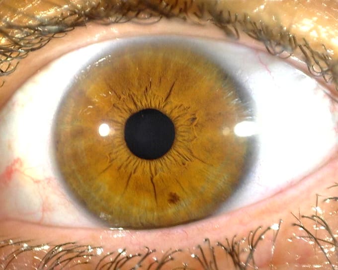do your iridology reading