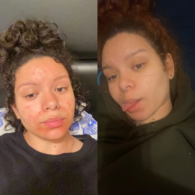 Create a skin care regimen for you by Drakepapa Fiverr