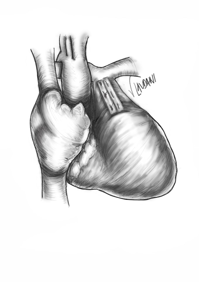 Illustrate surgical techniques and translate spanish english medical