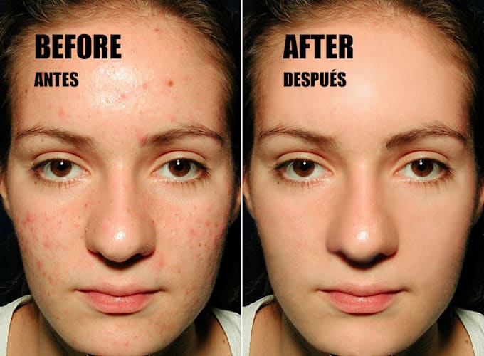 Delete the imperfections on your photo by Erifarfan Fiverr