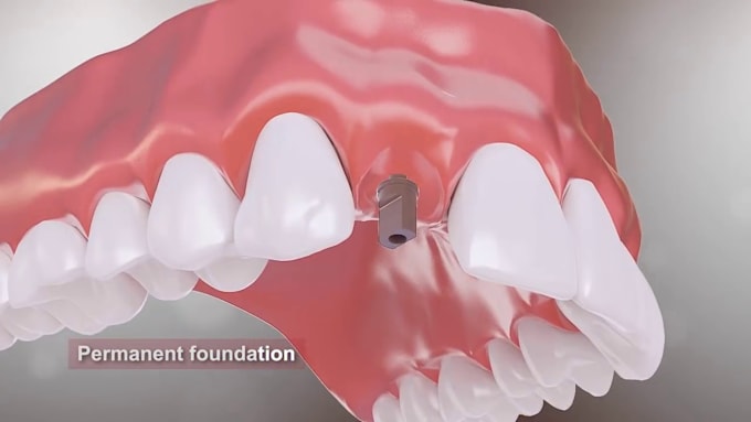 create well explanatory and realistic 3d medical animation video, dental video