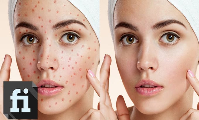 retouch-your-image-remove-pimples-blemishes-using-photoshop-a159.jpg