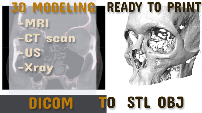 Création de modèle anatomique en impression 3D pour le domaine