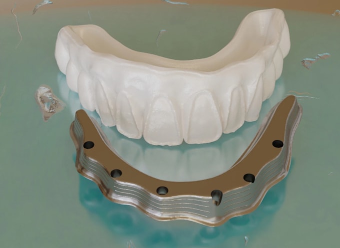 design 3d dental bar substructure