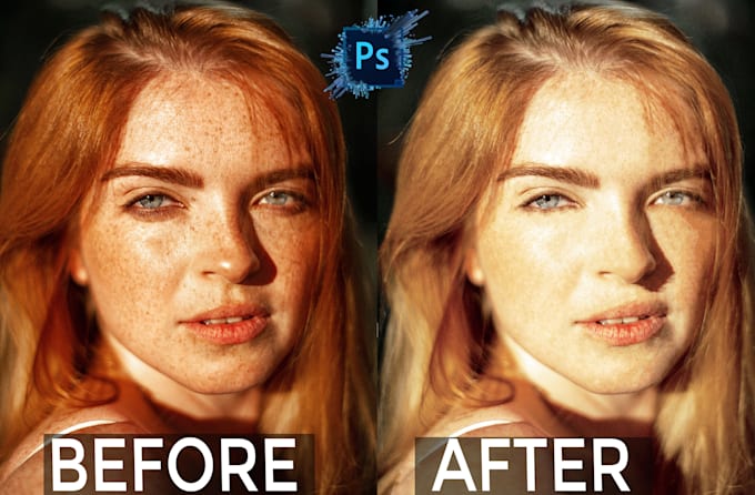 quickly remove pimples marks and dark spots, acne, from face